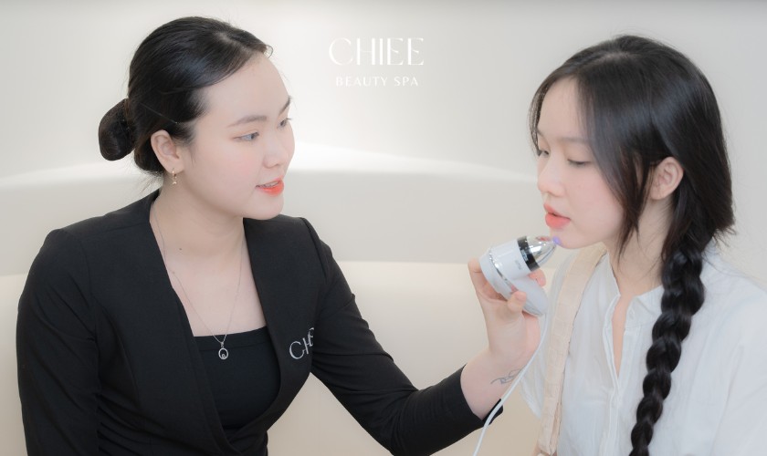 Chăm sóc da mụn chuyên sâu 17 bước