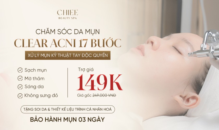 Chăm sóc da mụn chuyên sâu 17 bước